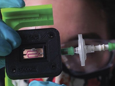 Implantable device that delivers insulin to Type 1 diabetics
