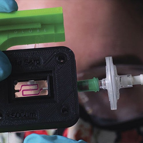 Implantable device that delivers insulin to Type 1 diabetics